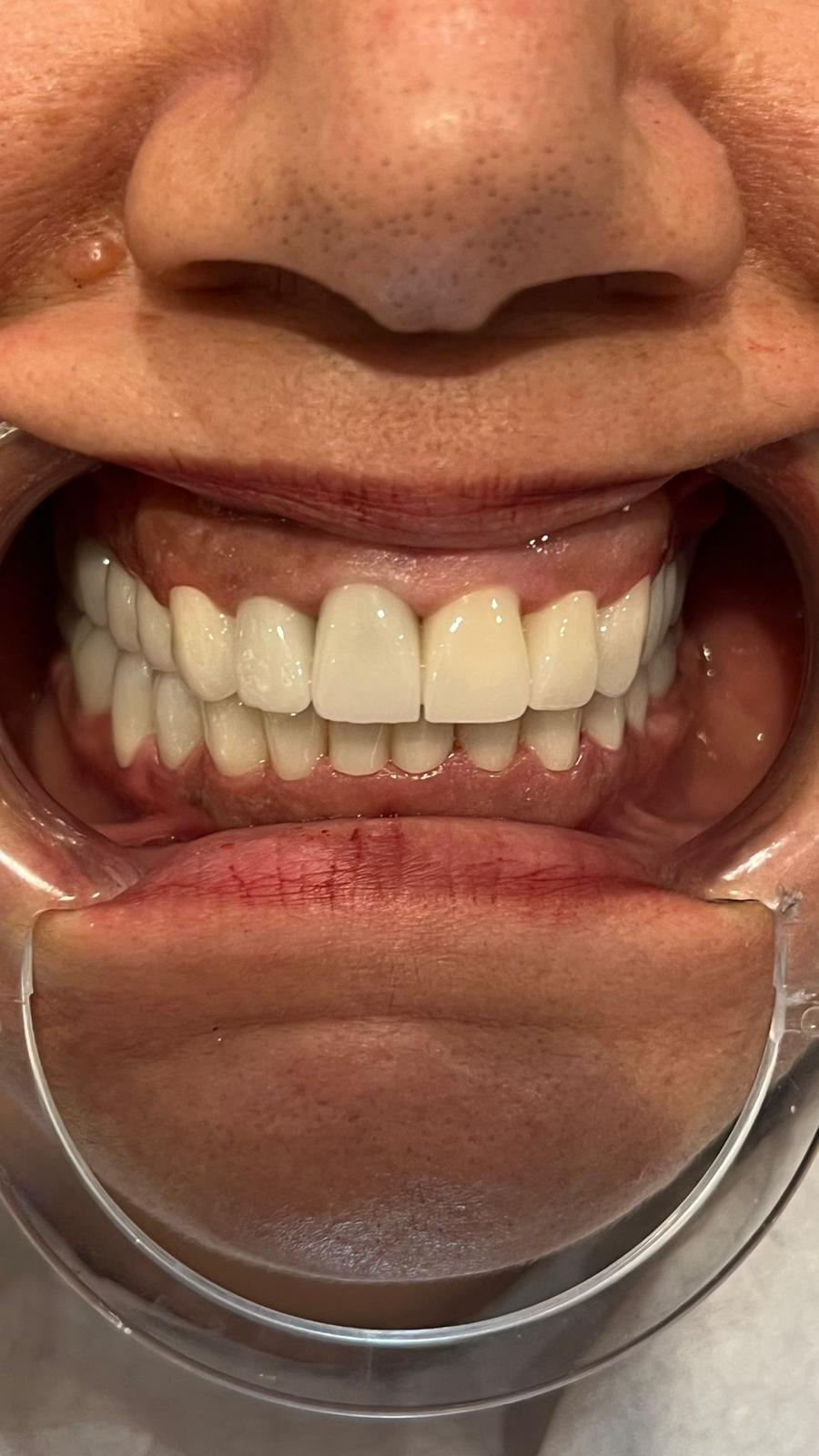 ECE Dental Patient Transformation